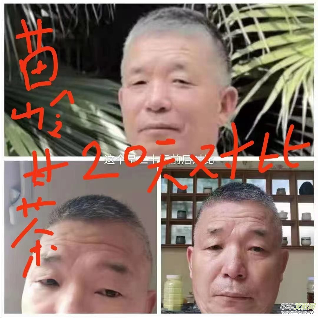 苗醫(yī)慢病快治專家范景良 苗醫(yī)慢病快治專家范景良