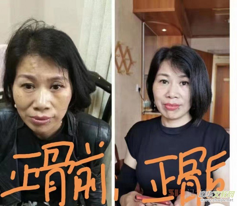 高級反射蜂療專家范景良 高級反射蜂療專家范景良