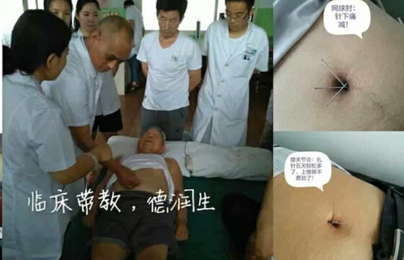 易象臍針療法傳承人——王培根 易象臍針療法傳承人——王培根